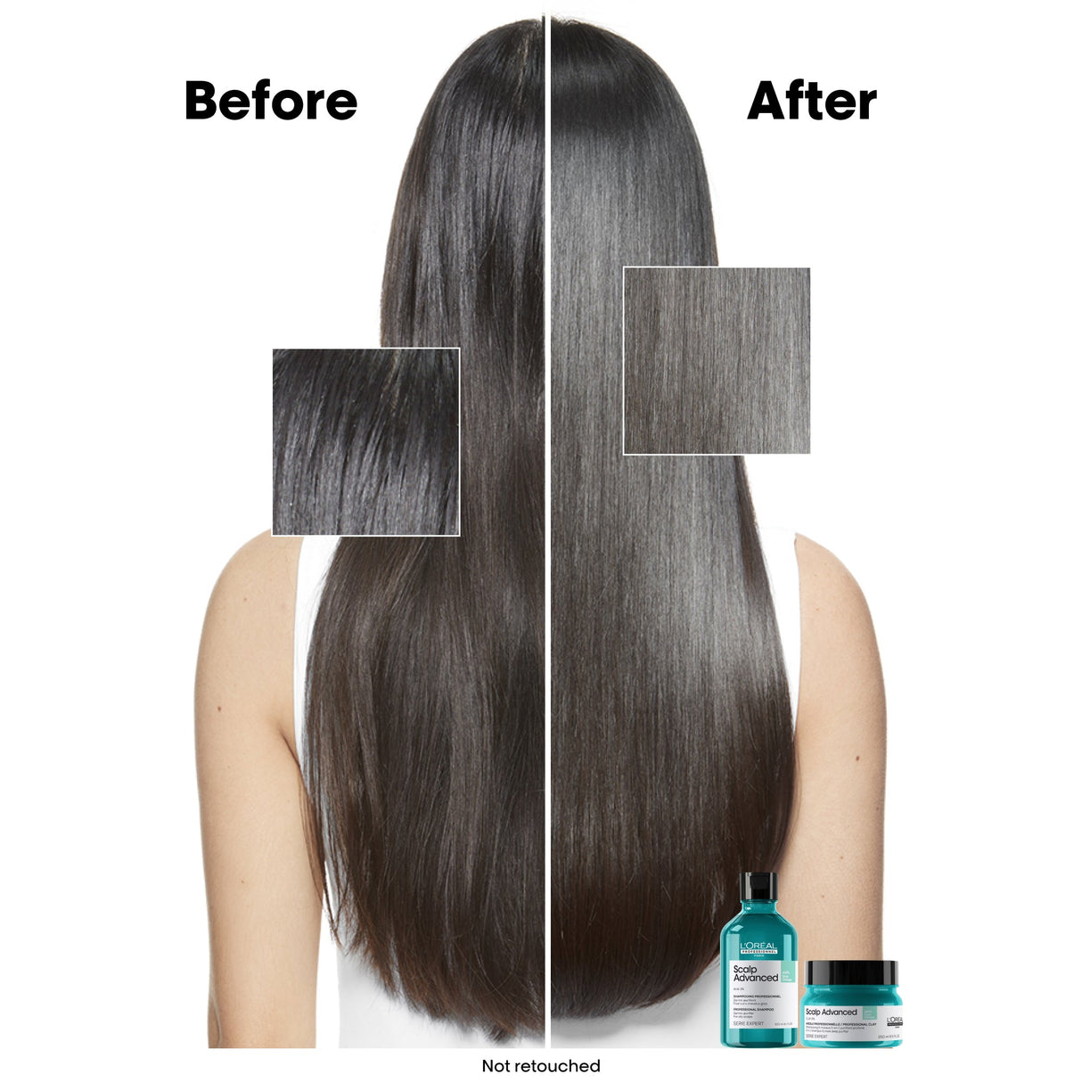 L'Oreal Professionnel Scalp Advanced Anti-Oiliness Dermo-Purifier Shampoo 300ml