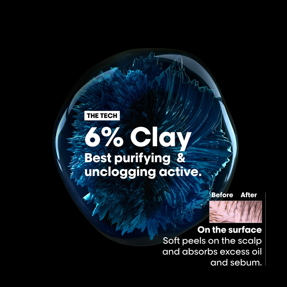 L'Oreal Professionnel Scalp Advanced Anti-Oiliness Dermo-Purifier Shampoo 300ml